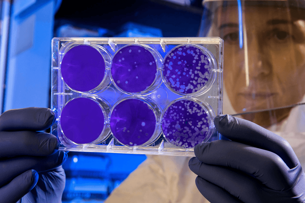 Petri dish MCS culture