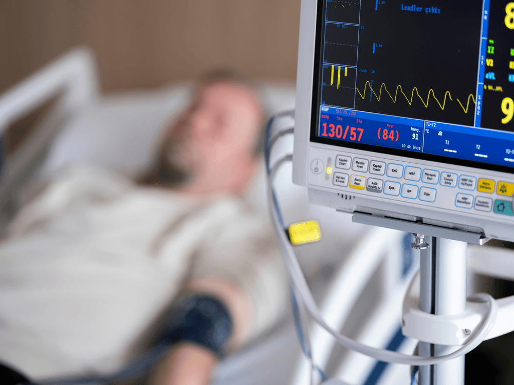 ECG monitor heartbeat