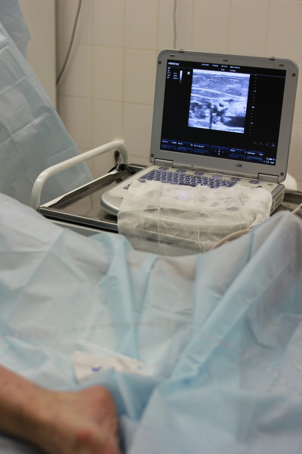 Ultrasound machine scan